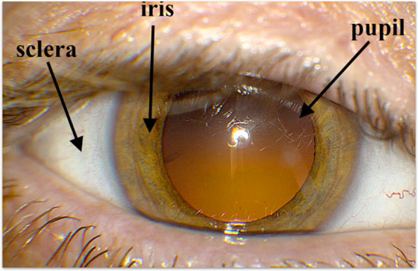 External eye anatomy diagram showing sclera, iris, and pupil