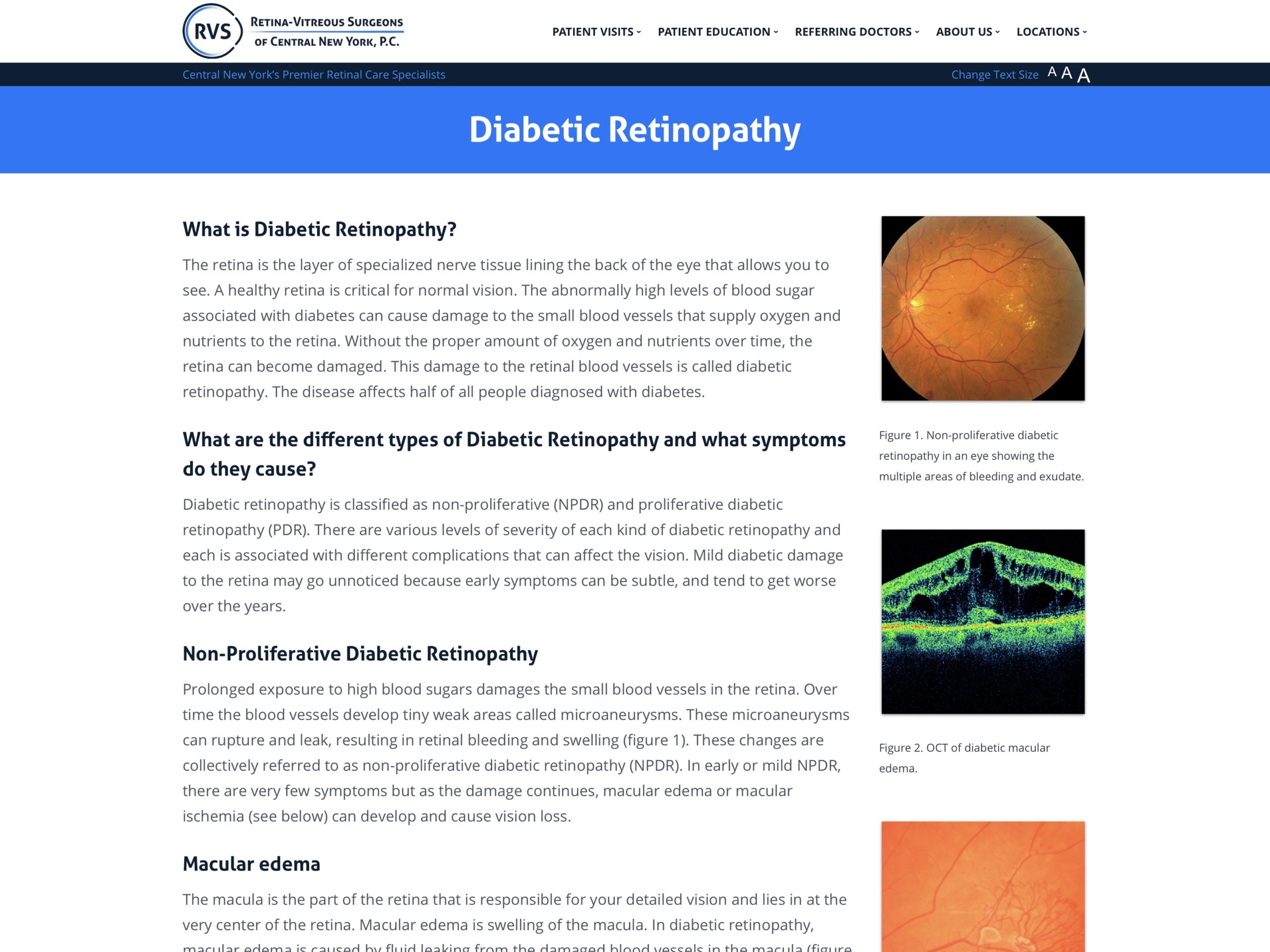 Diabetic retinopathy patient resources
