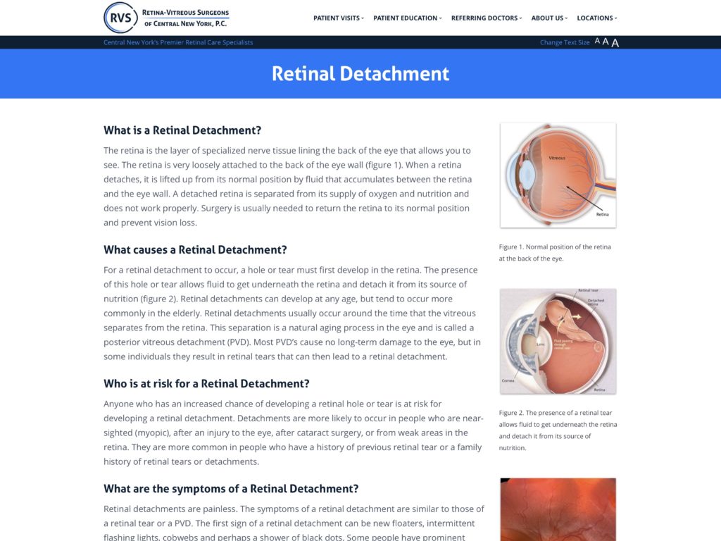 eye retina detachment operation