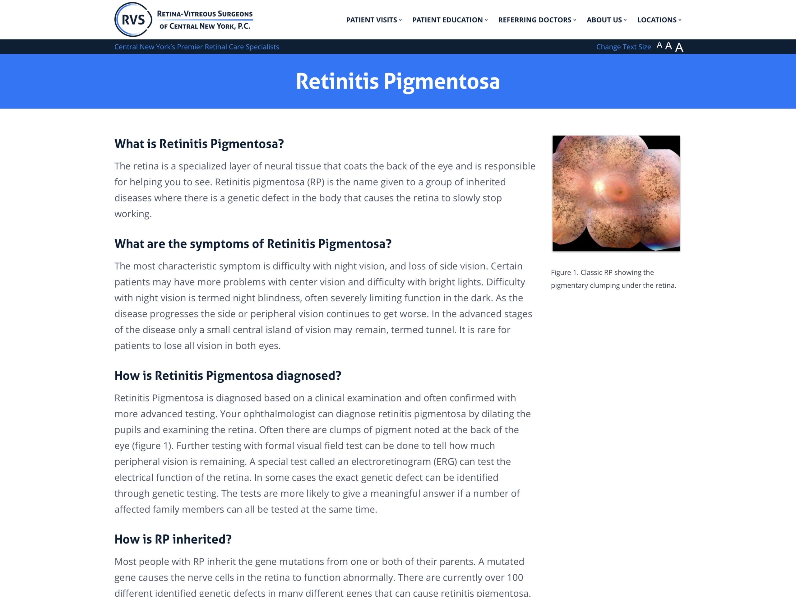 https://www.rvscny.com/wp-content/uploads/2019/12/Retinitis-Pigmentosa-%E2%80%93-Retina-Vitreous-Surgeons-of-CNY-2019-12-30-09-20-56-scaled.jpg